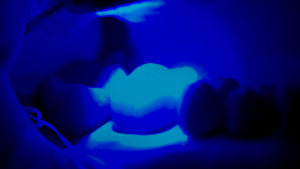 Dental procedure