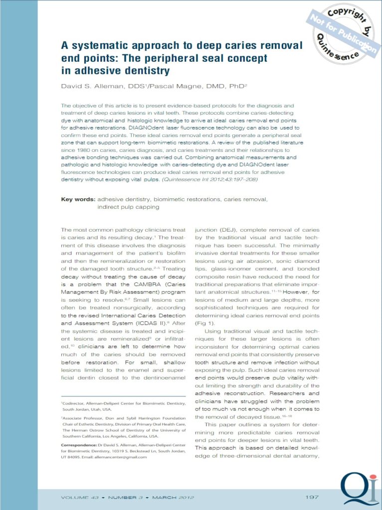 A systematic approach to deep caries removal end points: The peripheral seal concept in adhesive dentistry article by David S. Alleman and Pascal Magne