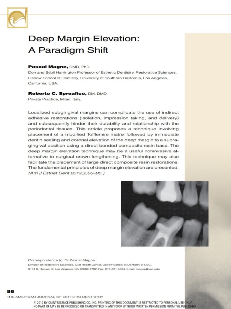 Deep Margin Elevation: A Paradigm Shift article by Pascal Magne and Roberto C. Spreafico