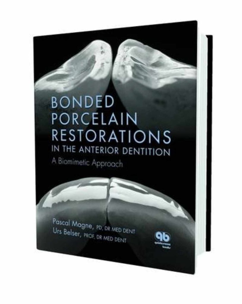 Bonded Porcelain Restorations In The Anterior Dentition A Biomimetic Approach Book By Pascal Magne and Urs Belser