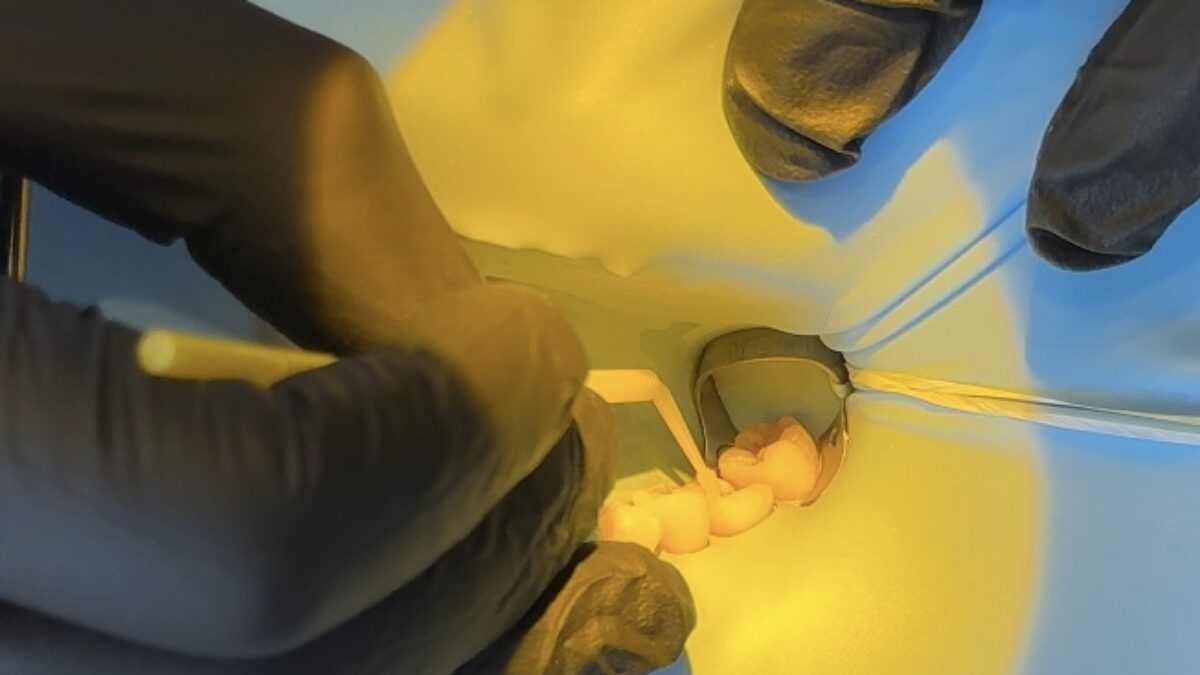 Biomimetic Restorative Dentistry Online Course - Level I
