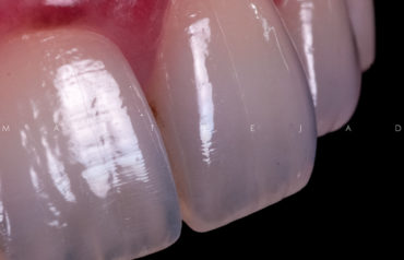 Esthetic Dentistry Courses