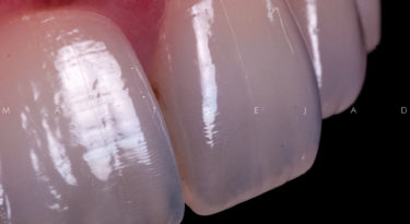 Esthetic Dentistry Courses