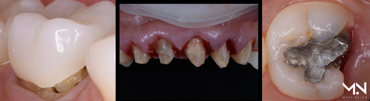 Examples of problems from traditional dentistry.
