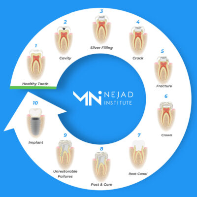 The tooth cycle of death illustration.