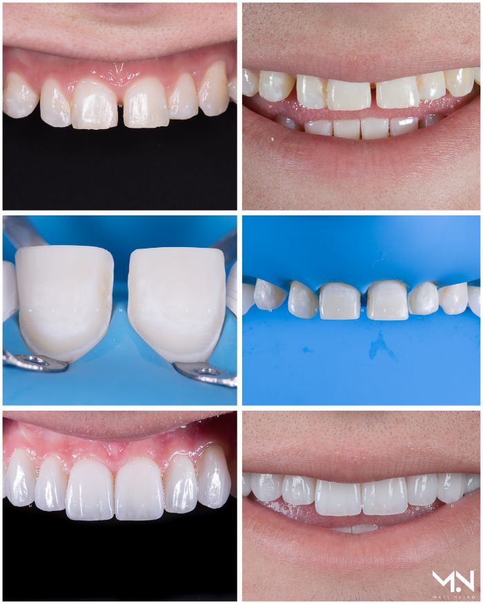 Compilation of Teeth photos