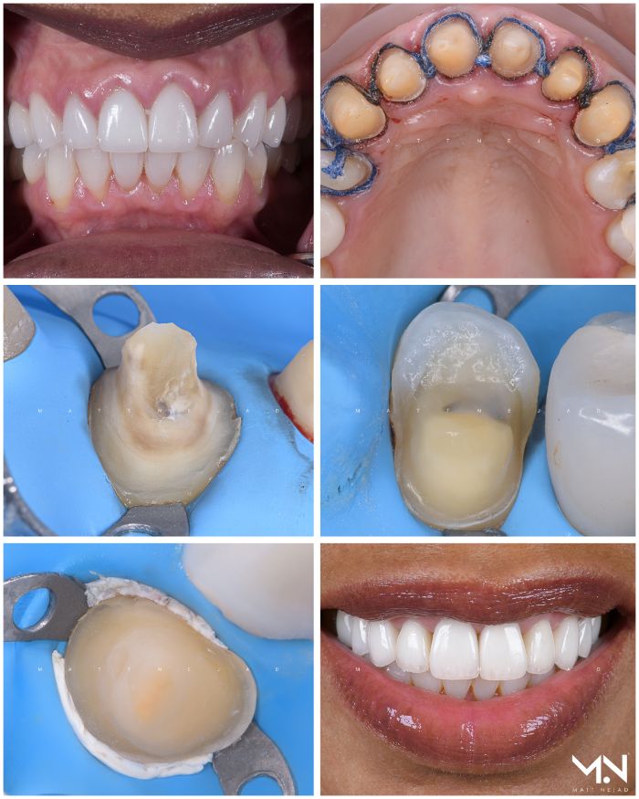 Compilation of Teeth photos