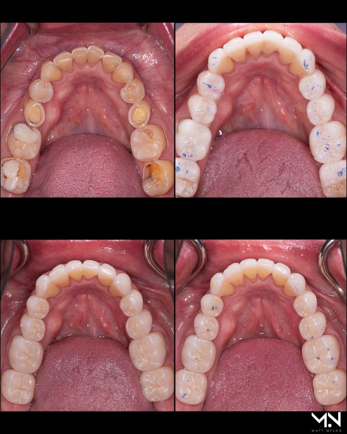 Compilation of Teeth photos